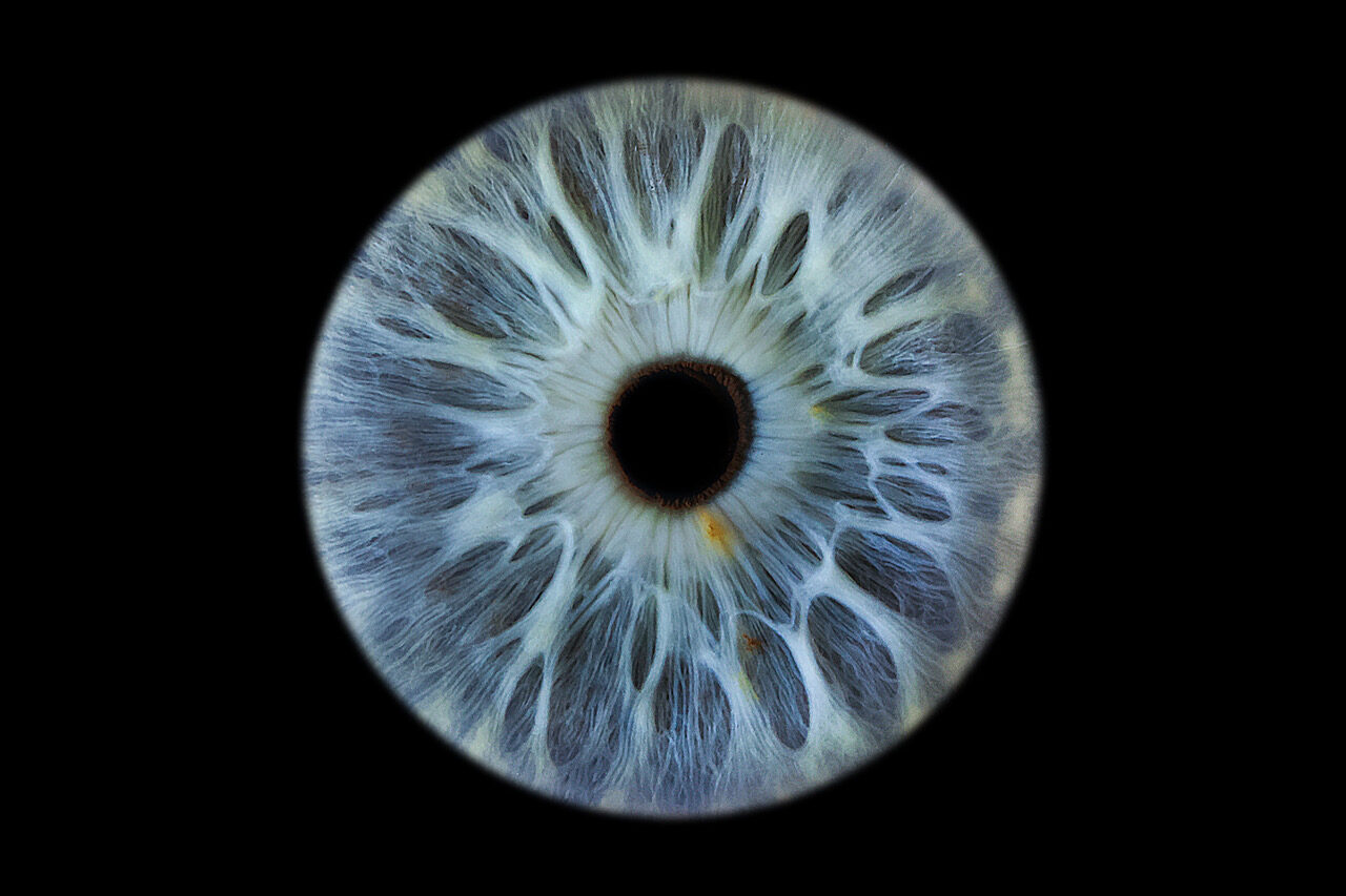iris