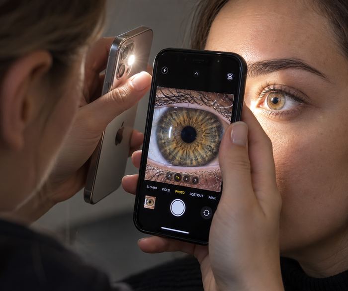 Taking a close-up human iris photo with a phone
